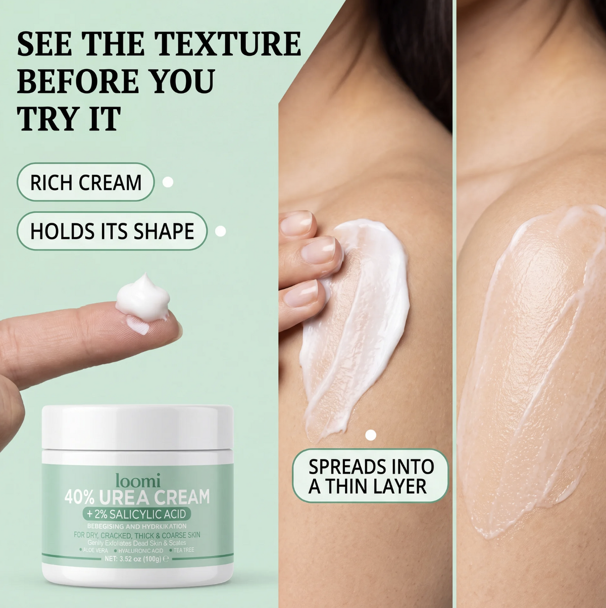 SK Renewal 40 — Advanced Keratolytic Cream For Rough, Raised Seborrheic Keratoses